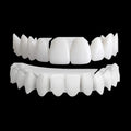 Shiny Smile Snap-On Veneers
